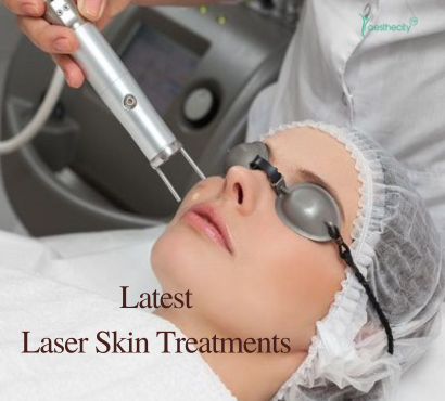 The Latest Innovations in Laser Skin Treatments